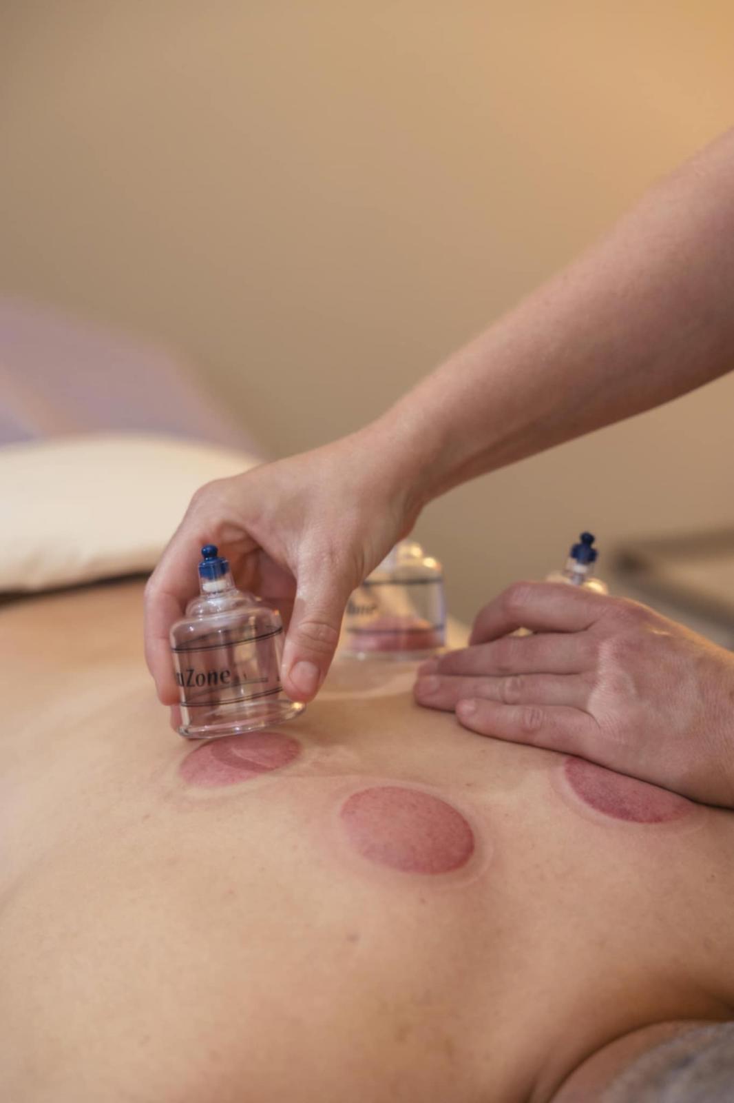 Cupping therapy being performed by Alli Strnad, LMT